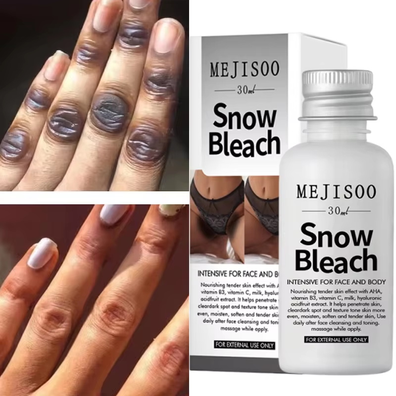 Korean Skincare Routine - Fast Whitening Dark Knuckles Brighten Hand