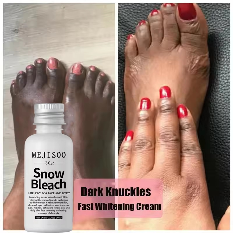 Fast Whitening Dark Knuckles B - Korean Skincare Routine ulasan dan harga